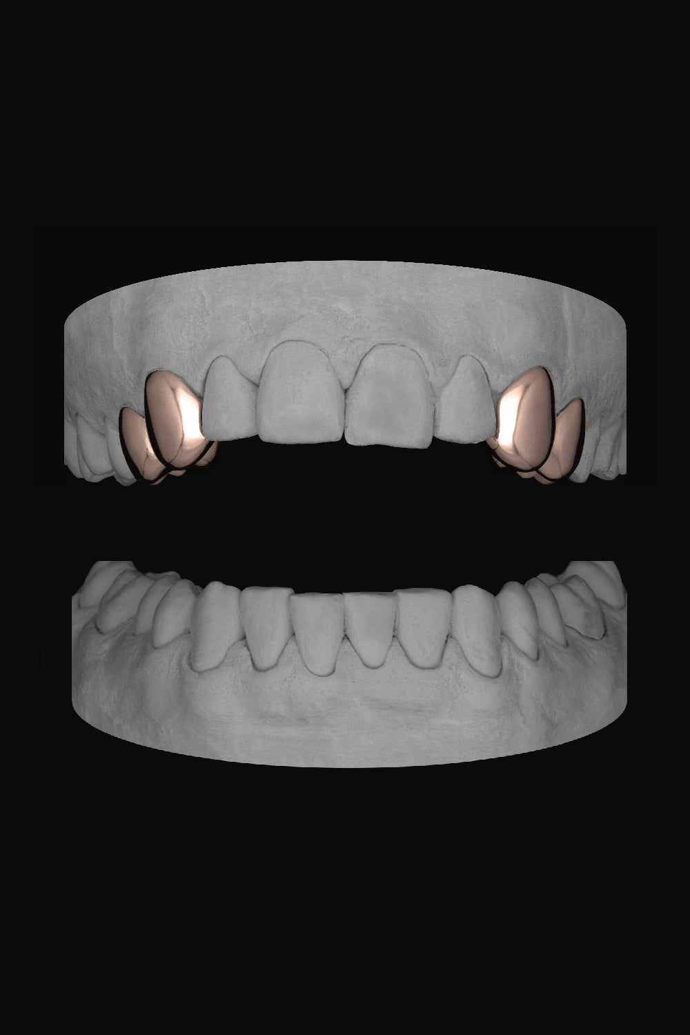 2 x Canine & Premolar (upper)
