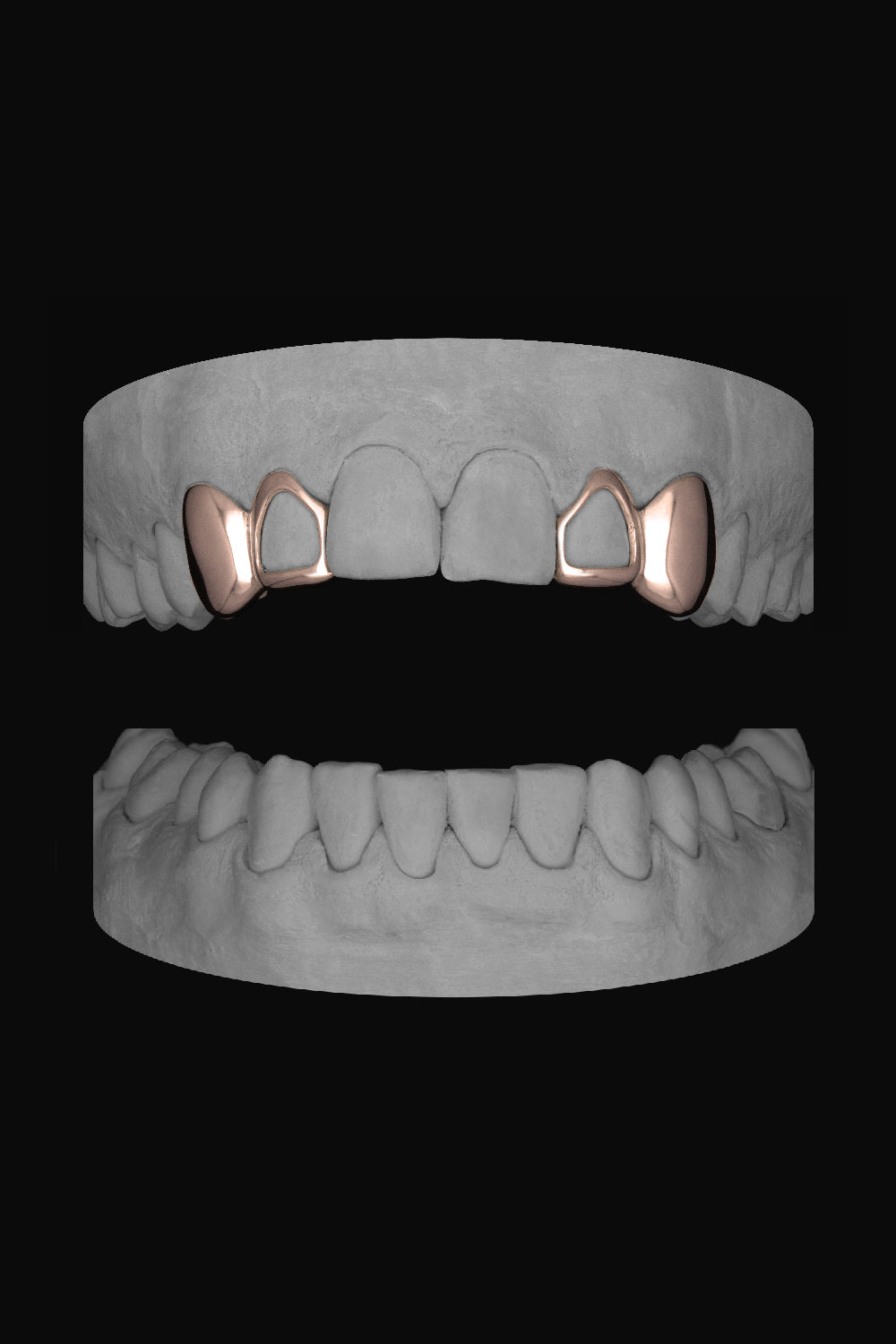 2 x Canine & Window Lateral
