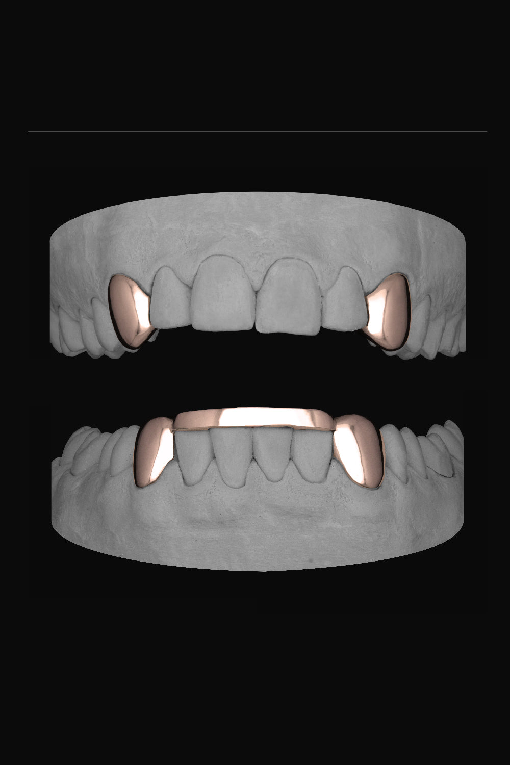 4 Canines with bar
