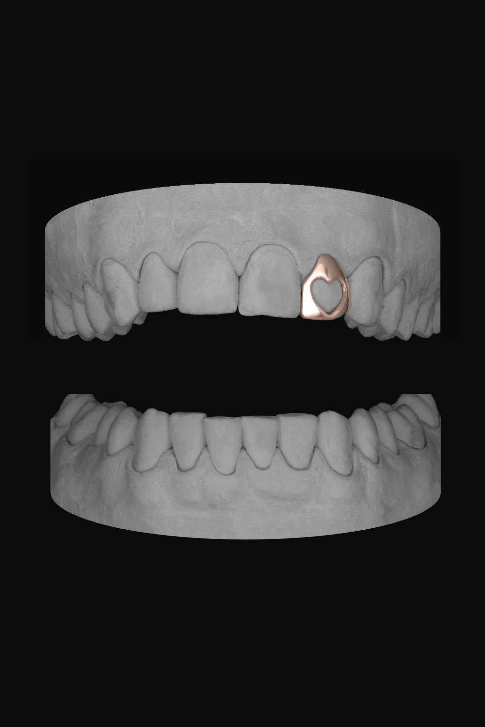 Heart Lateral