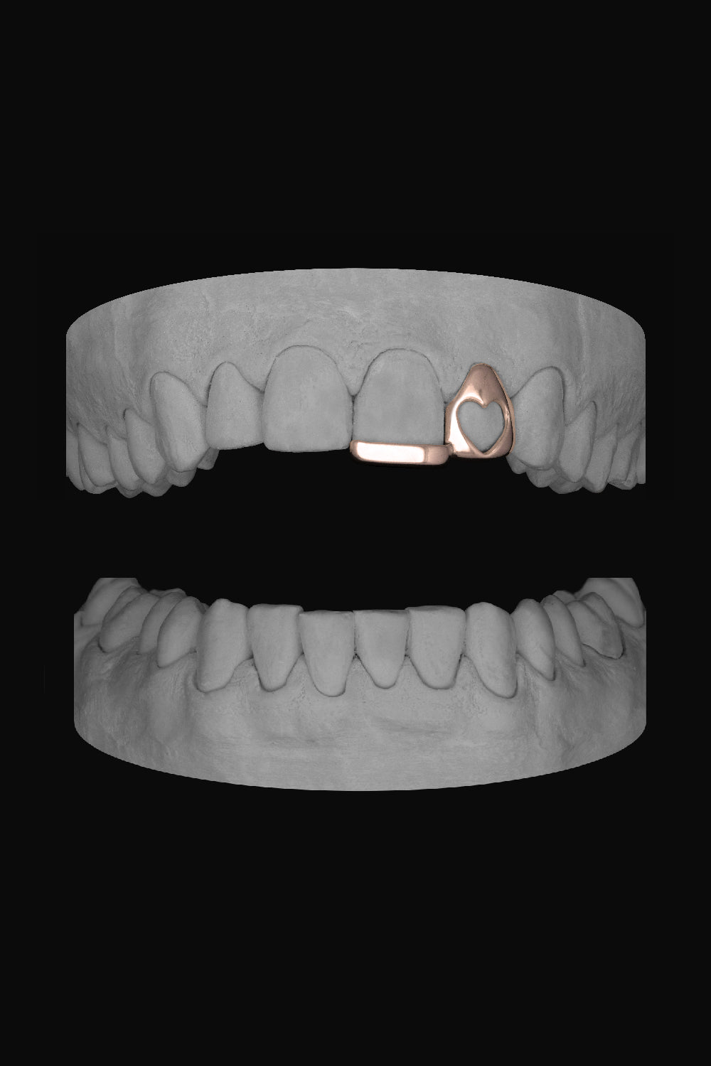 Heart Lateral & Bar