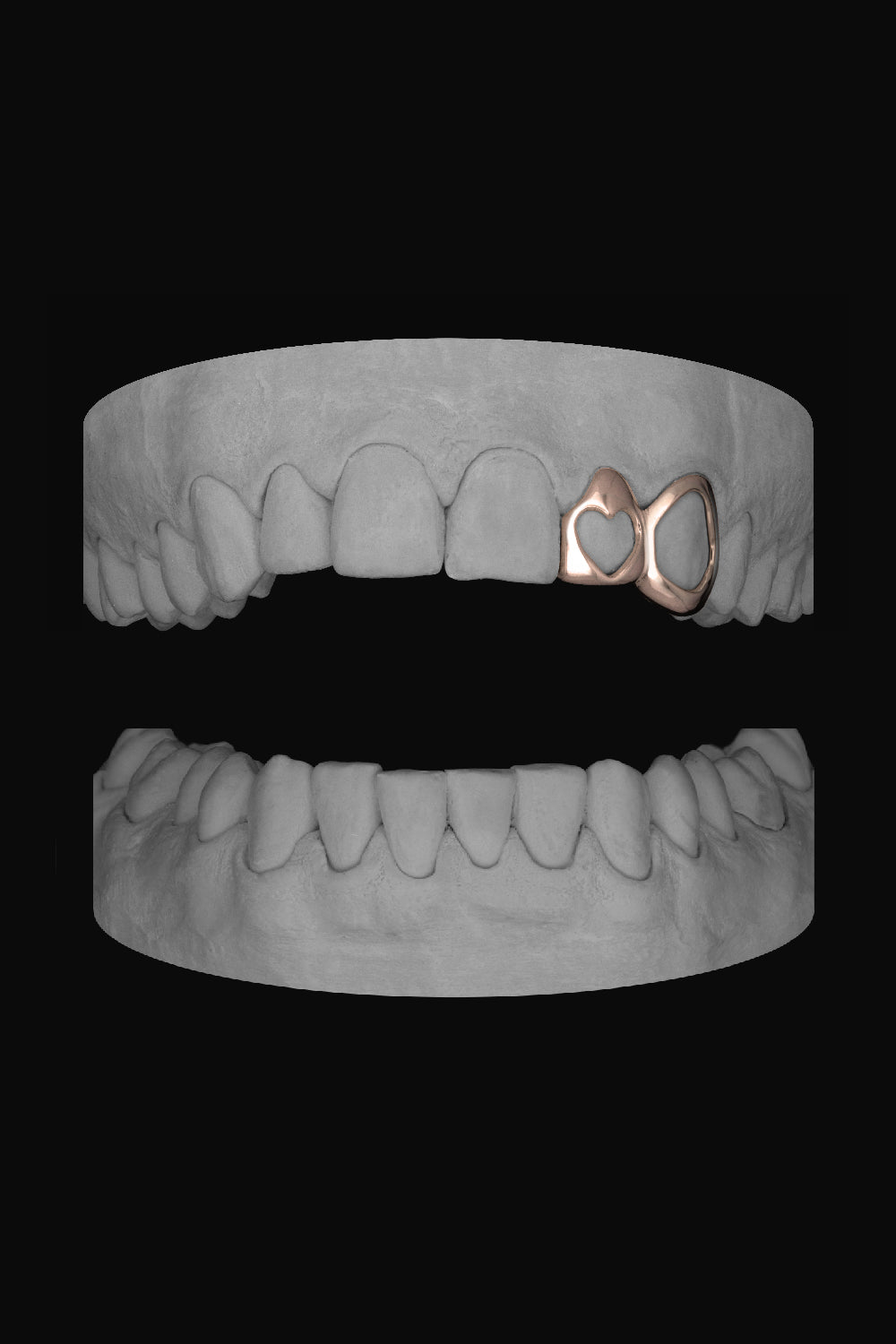 Heart Lateral & Window Canine