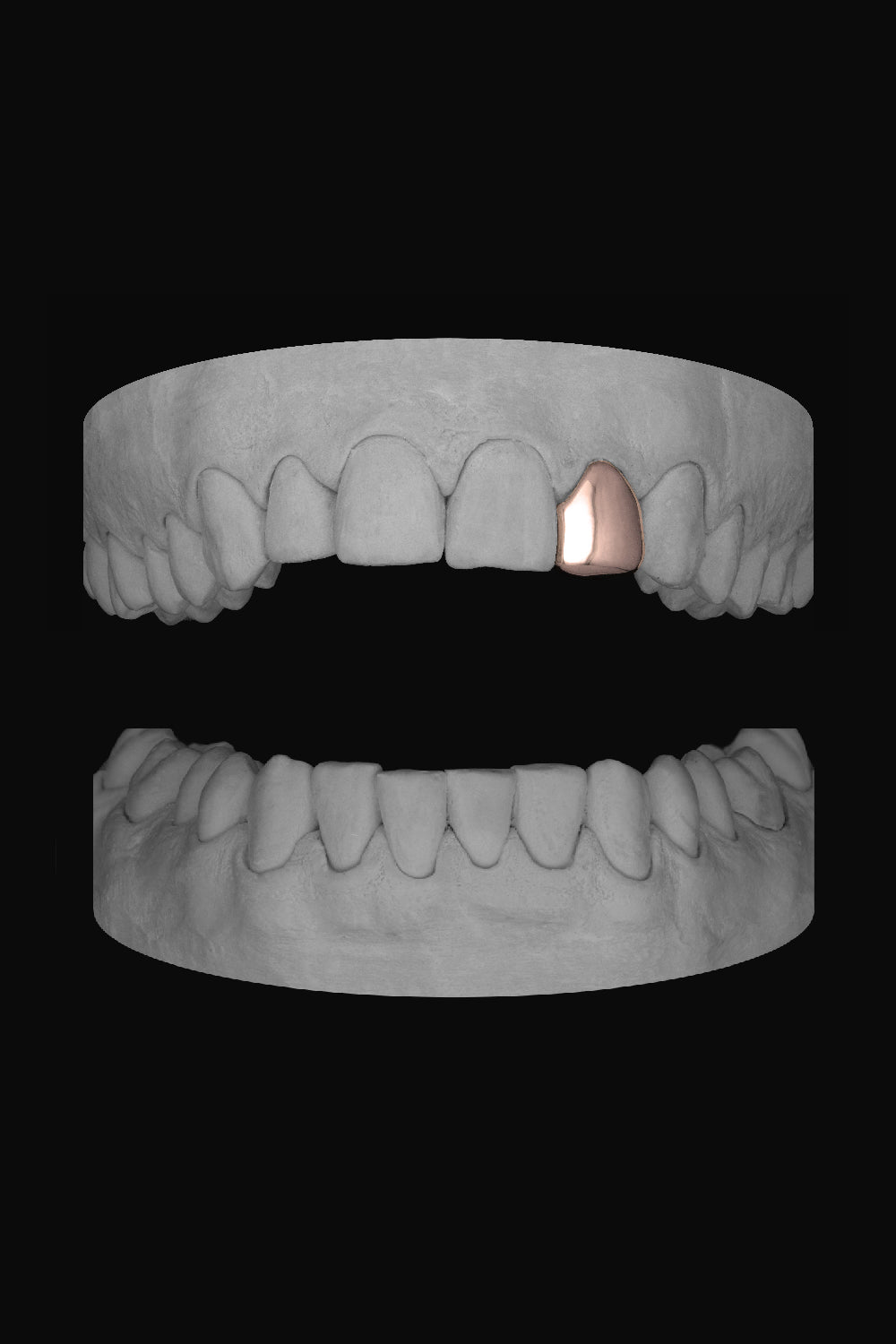 Lateral