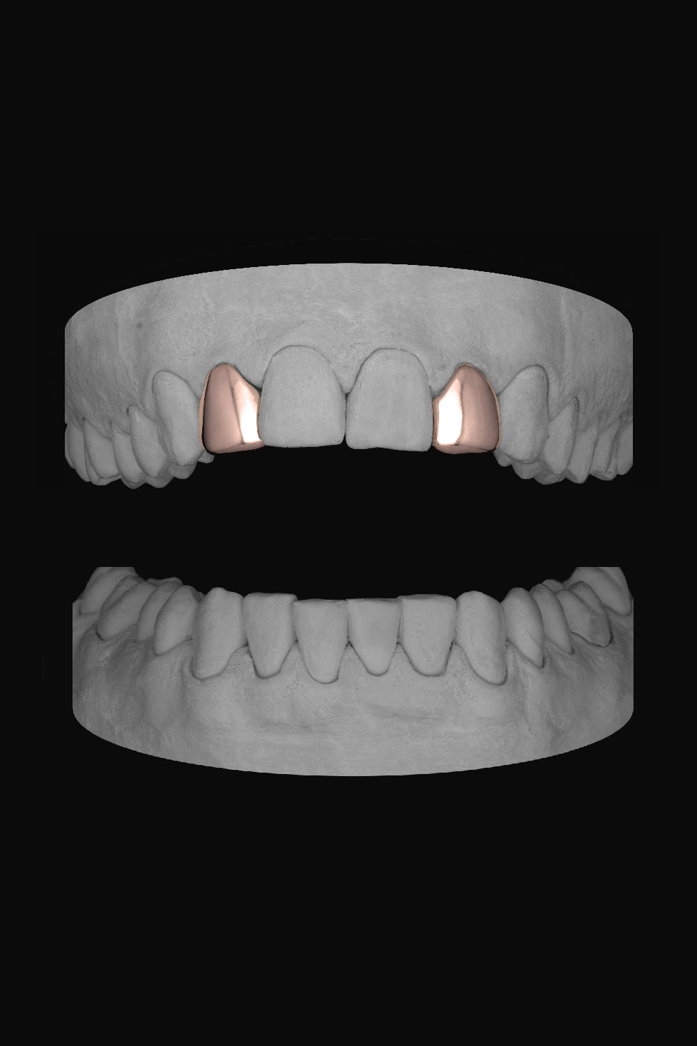 Lateral - Lateral