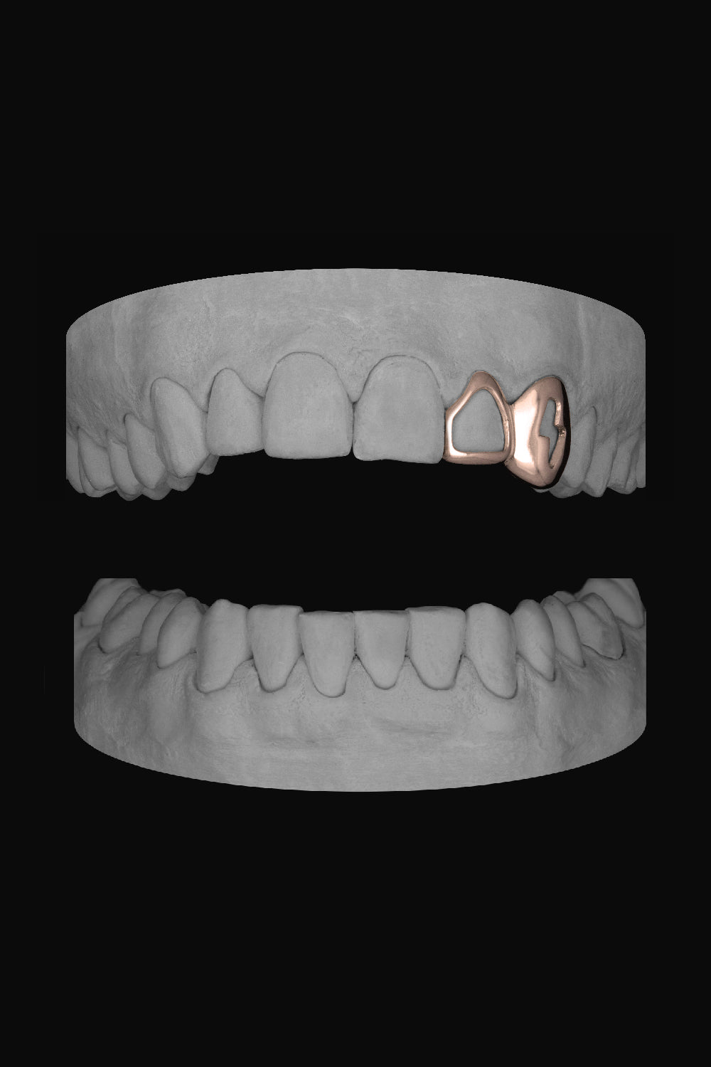 Window Lateral & Bolt Canine