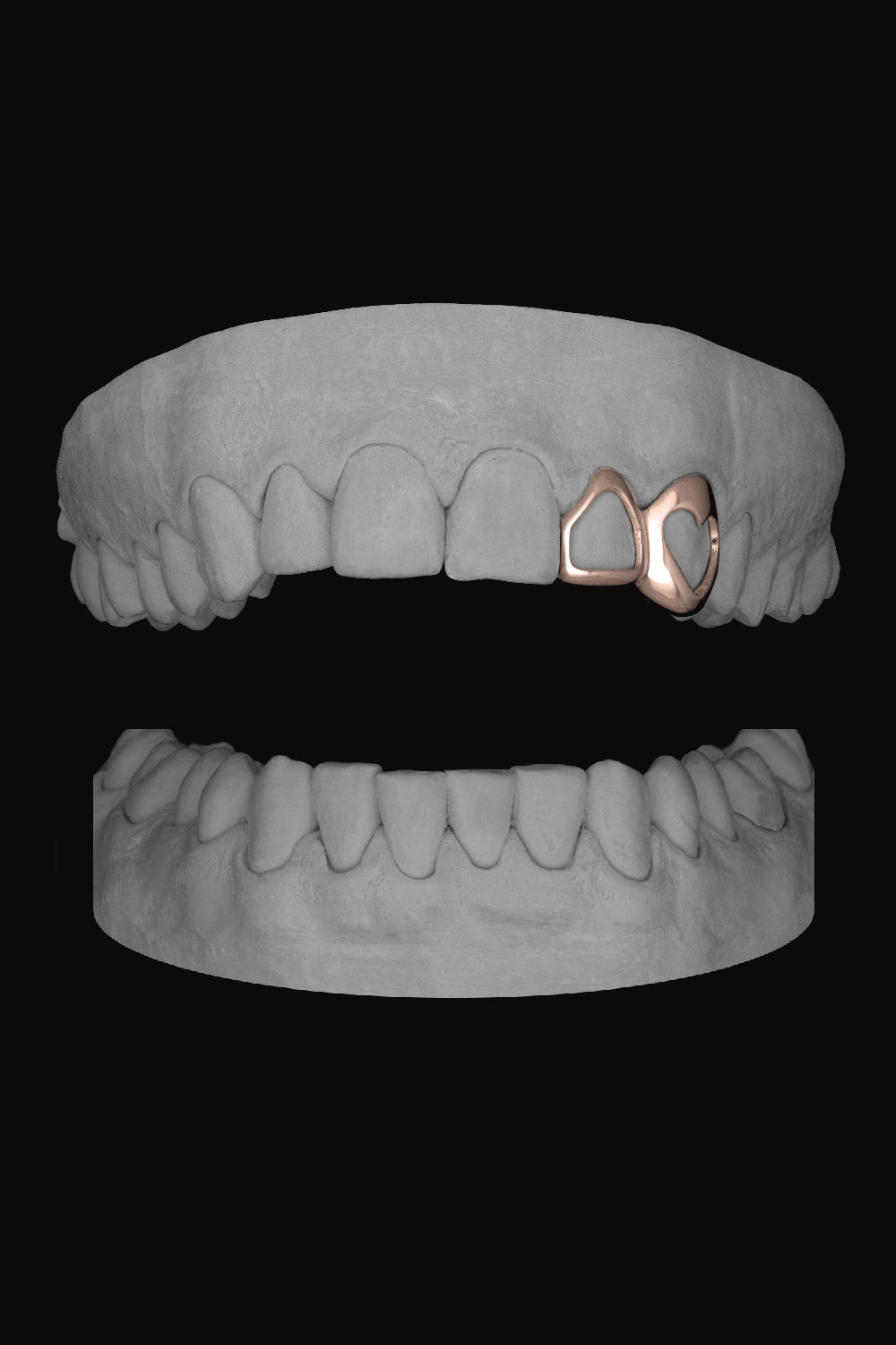 Window Lateral & Heart Canine