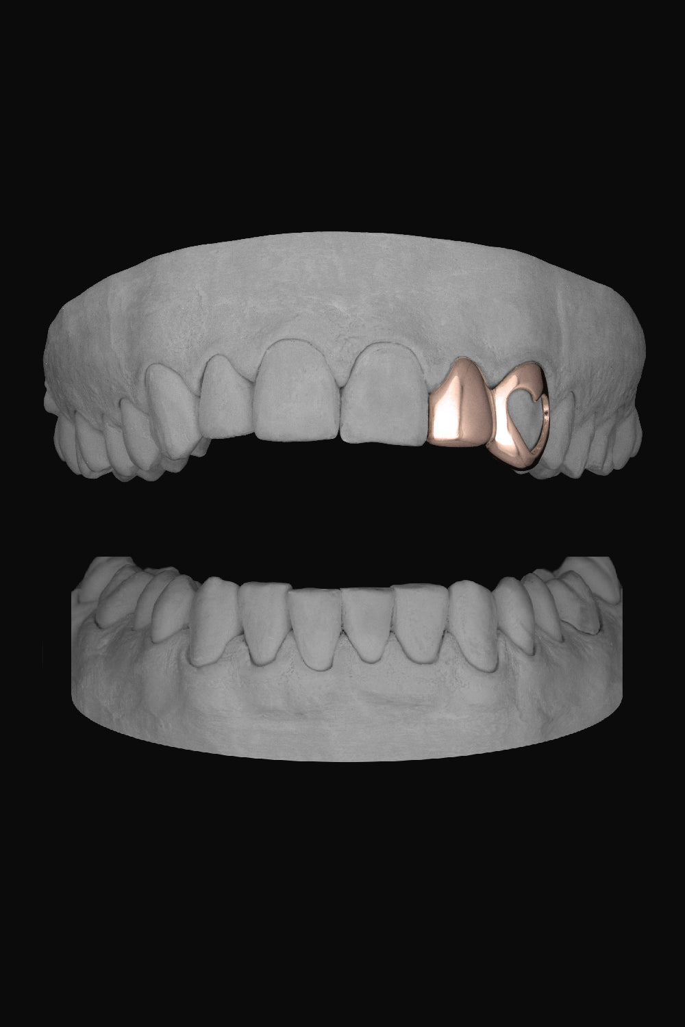 Lateral & Heart Canine