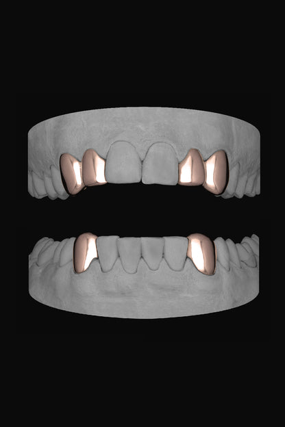 2 x Canine and Lateral & Bottom Canines