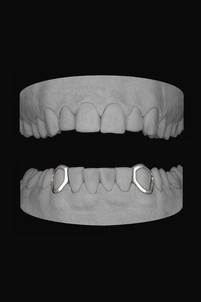 2 x Canine Windows (Lower)