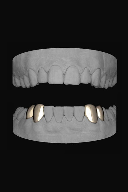 2 x Canine & premolar (Lower)