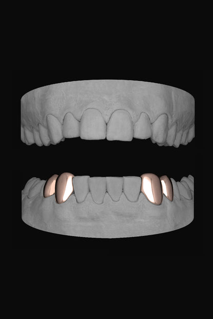2 x Canine & premolar (Lower)
