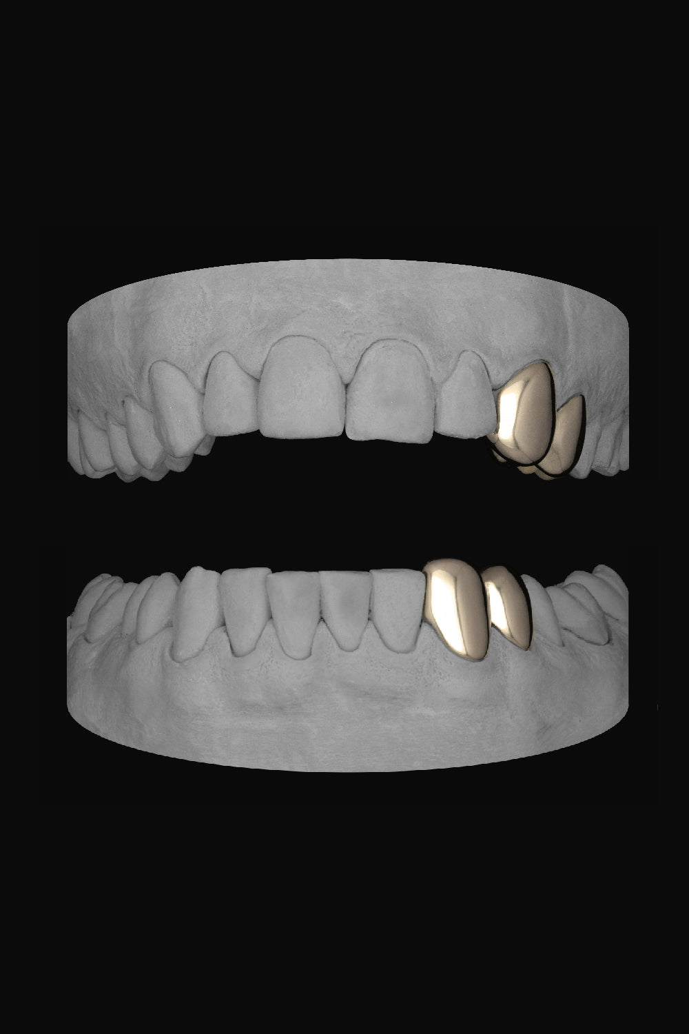 2 x Canine & Premolar (Upper & Lower)