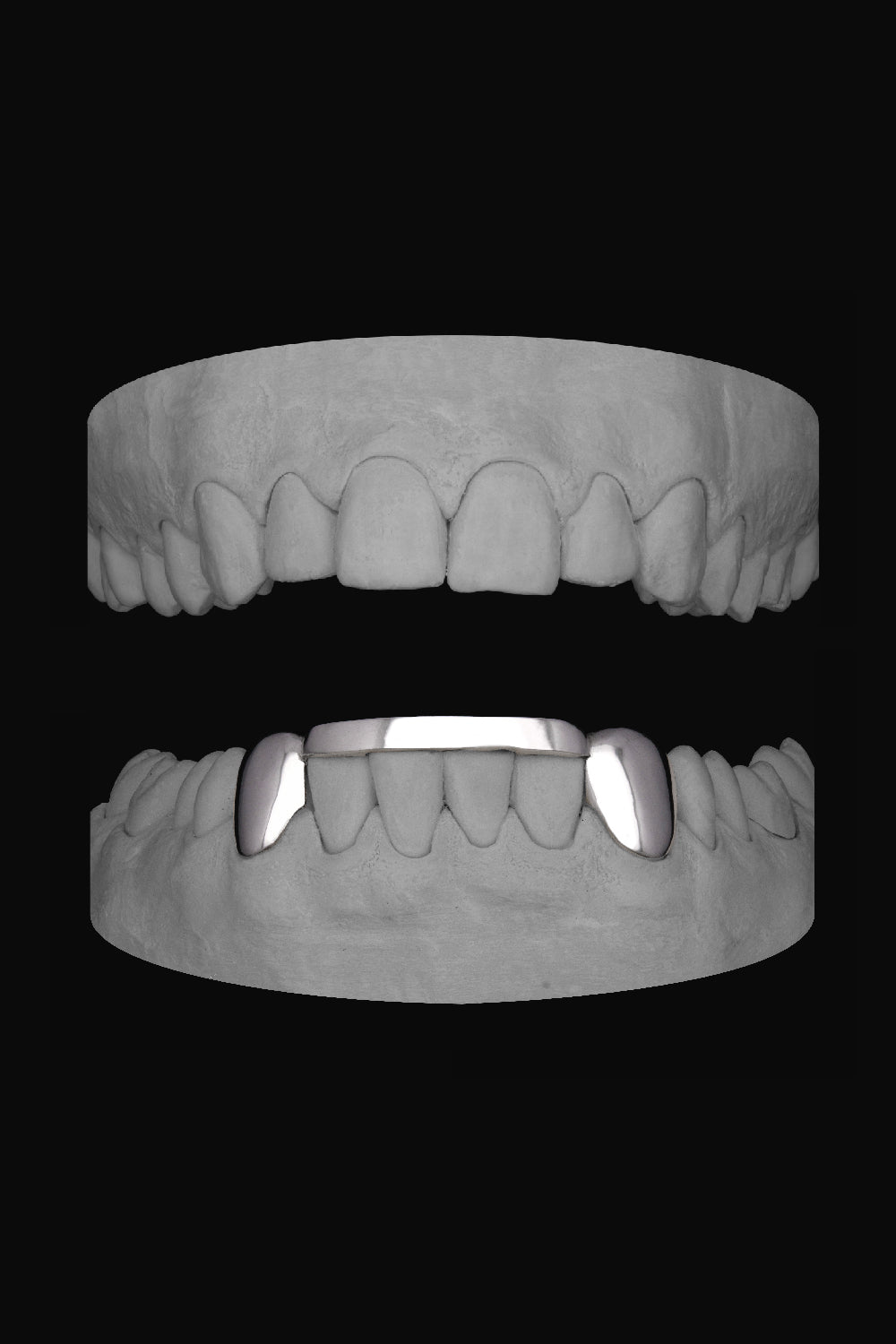 2 x Canines with Bar