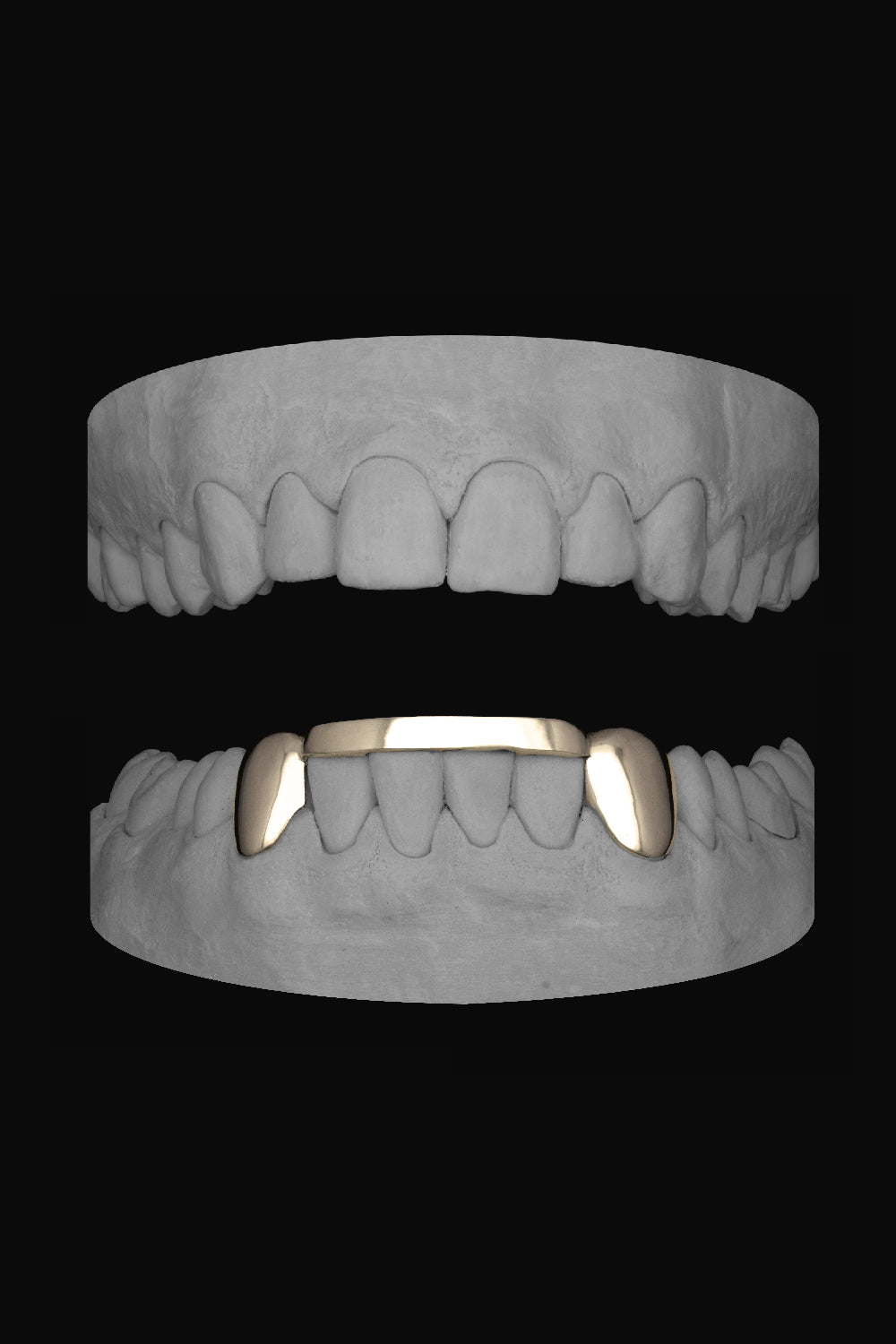 2 x Canines with Bar