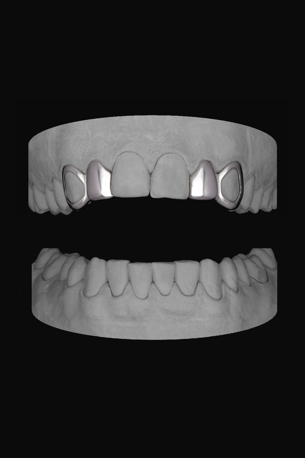 2 x Window Canine & Lateral