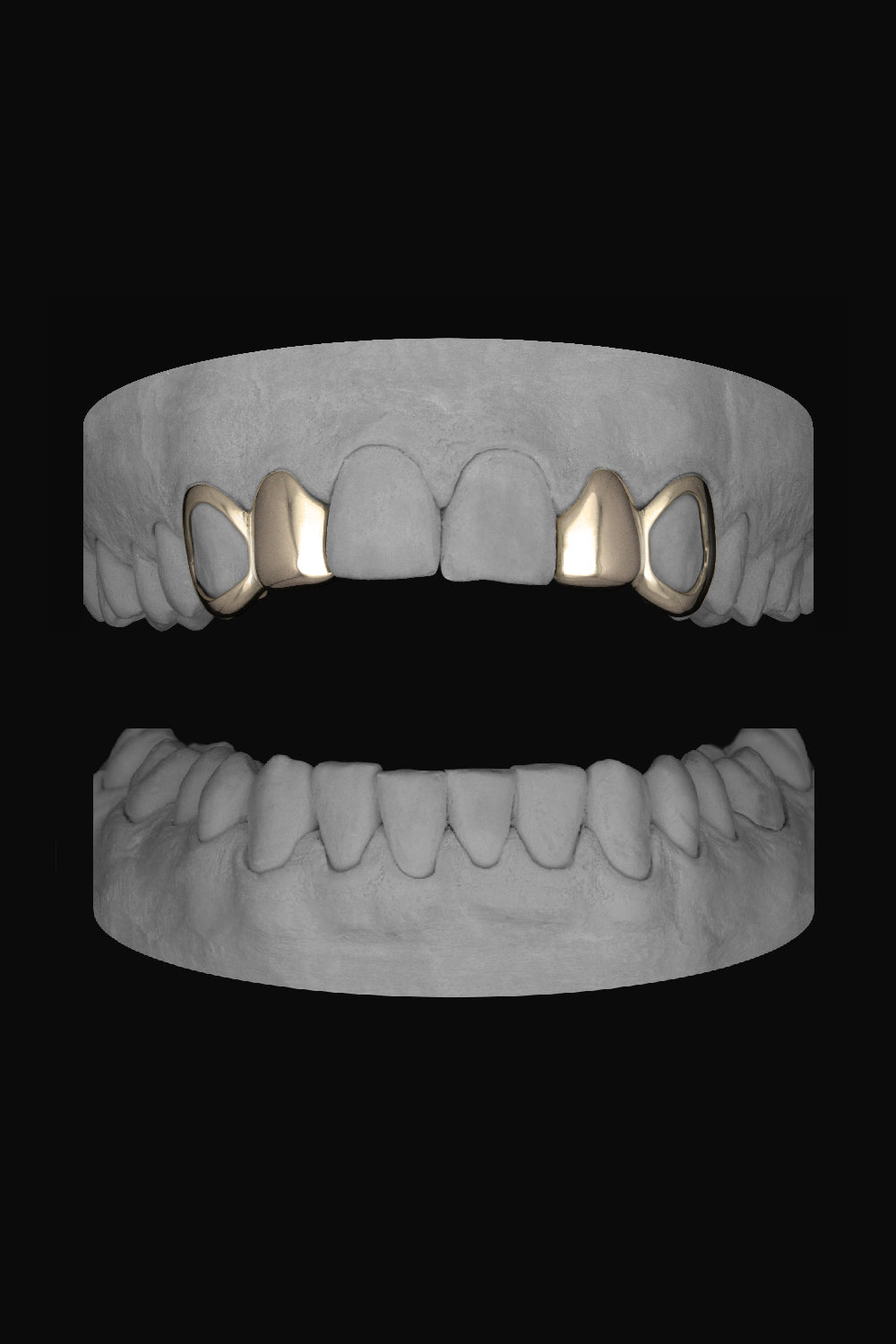 2 x Window Canine & Lateral