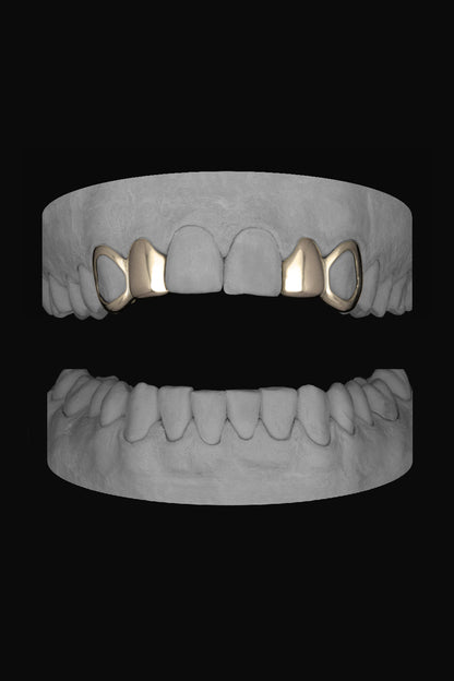 2 x Window Canine & Lateral