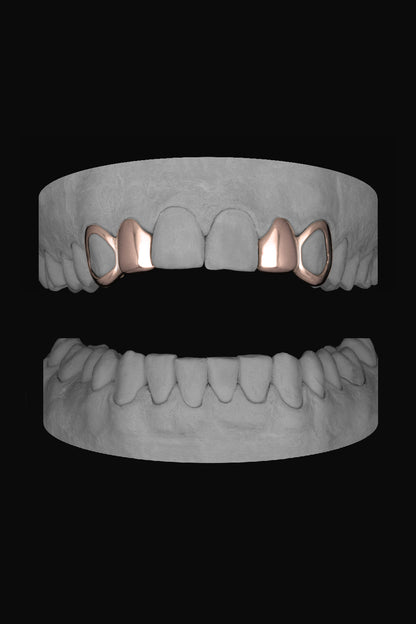 2 x Window Canine & Lateral