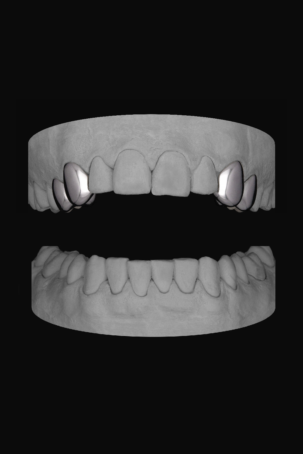 2 x Canine & Premolar (upper)