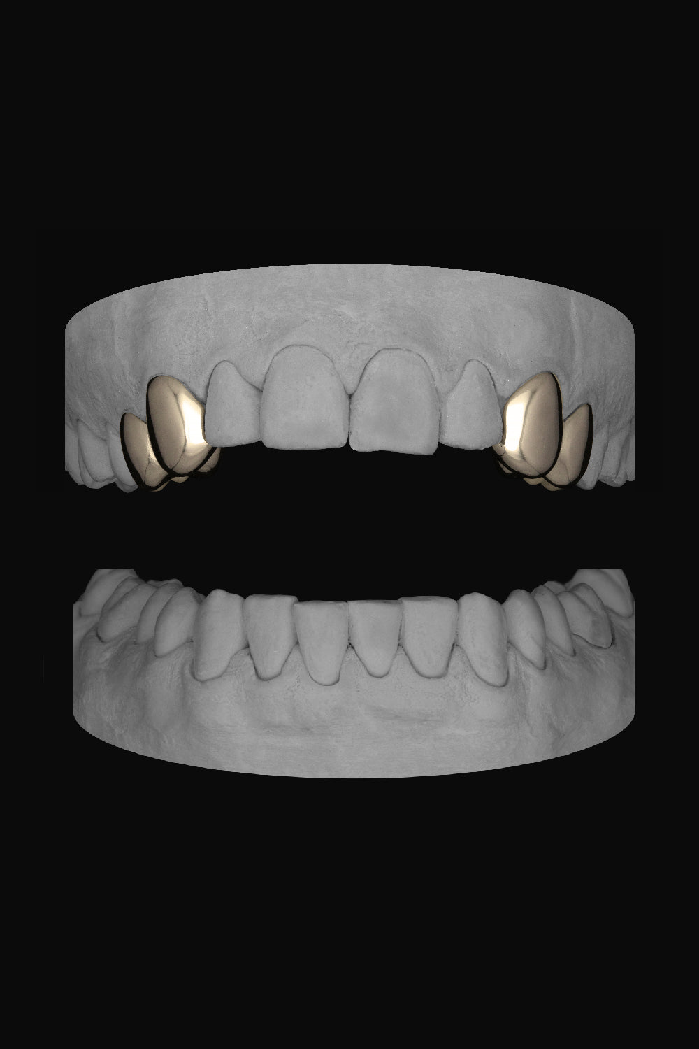 2 x Canine & Premolar (upper)