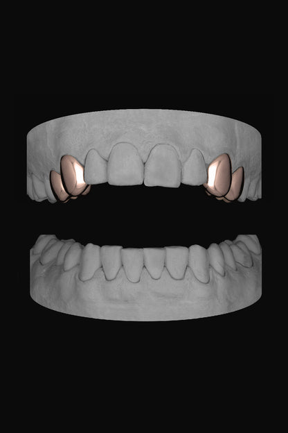 2 x Canine & Premolar (upper)
