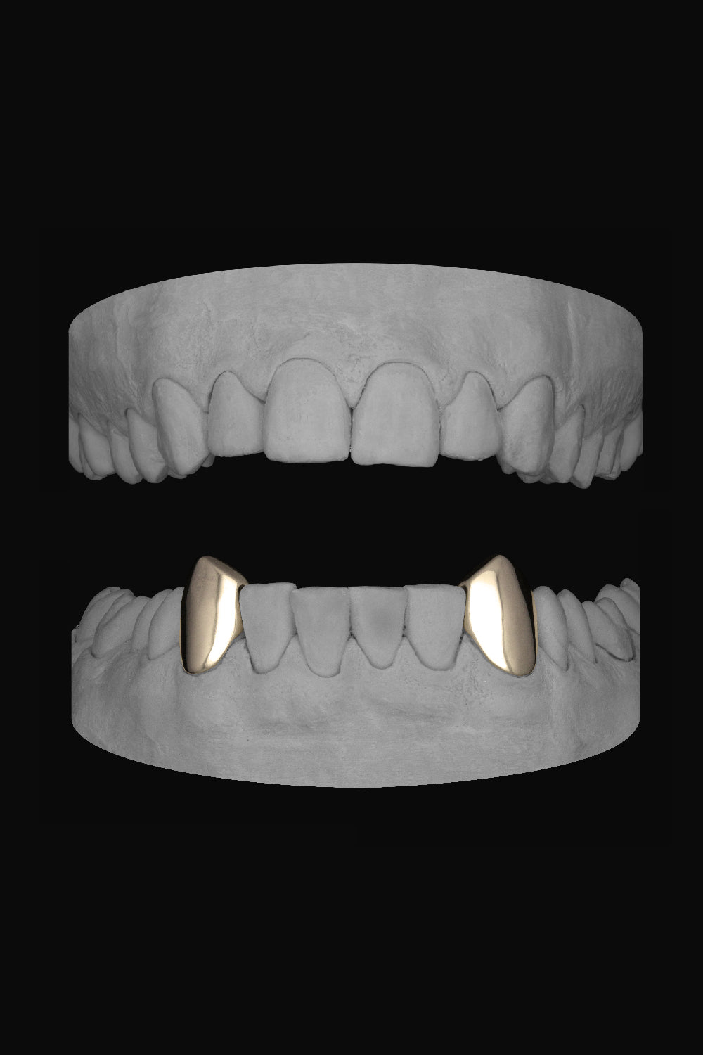 Vampire Canines (Lower)