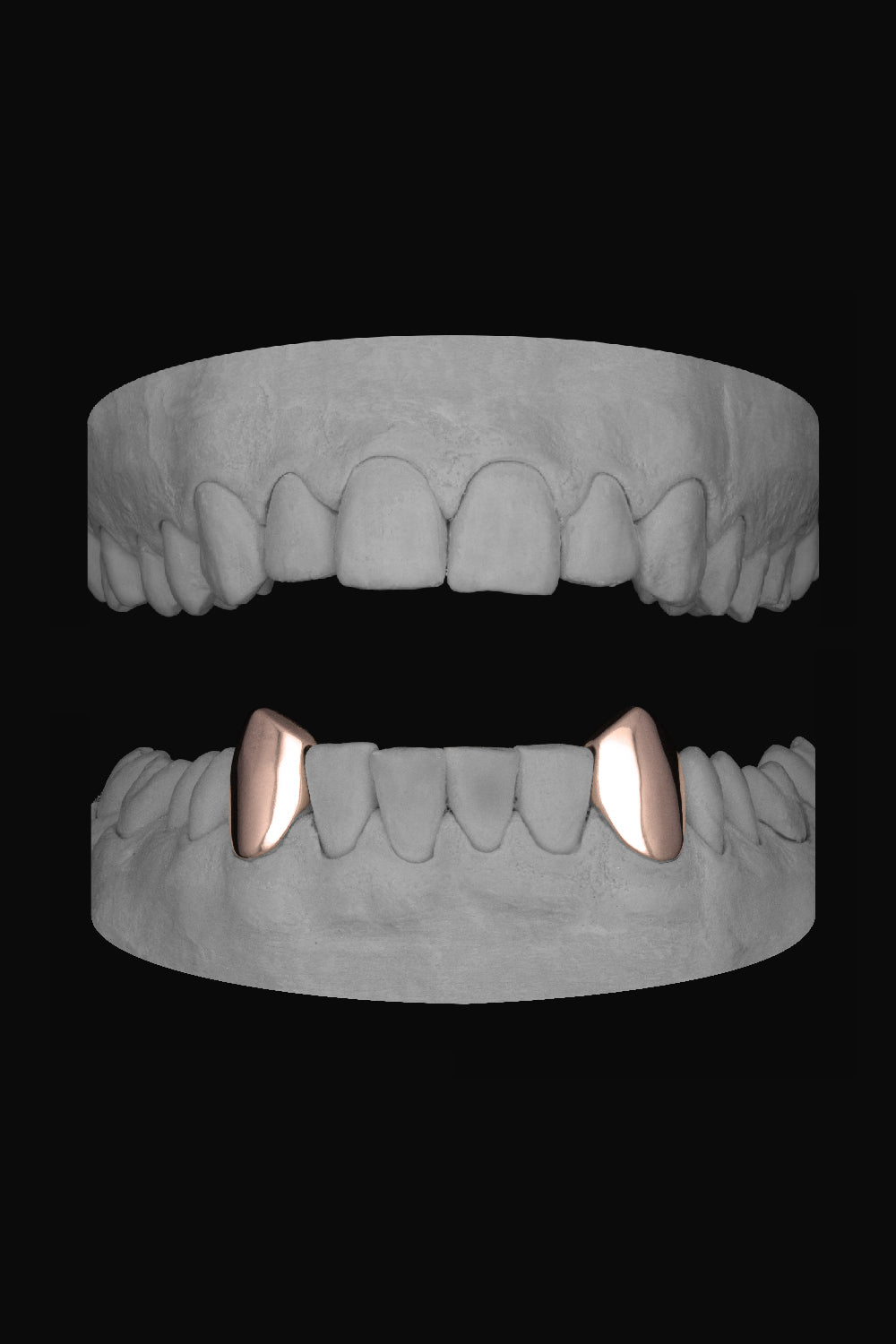 Vampire Canines (Lower)
