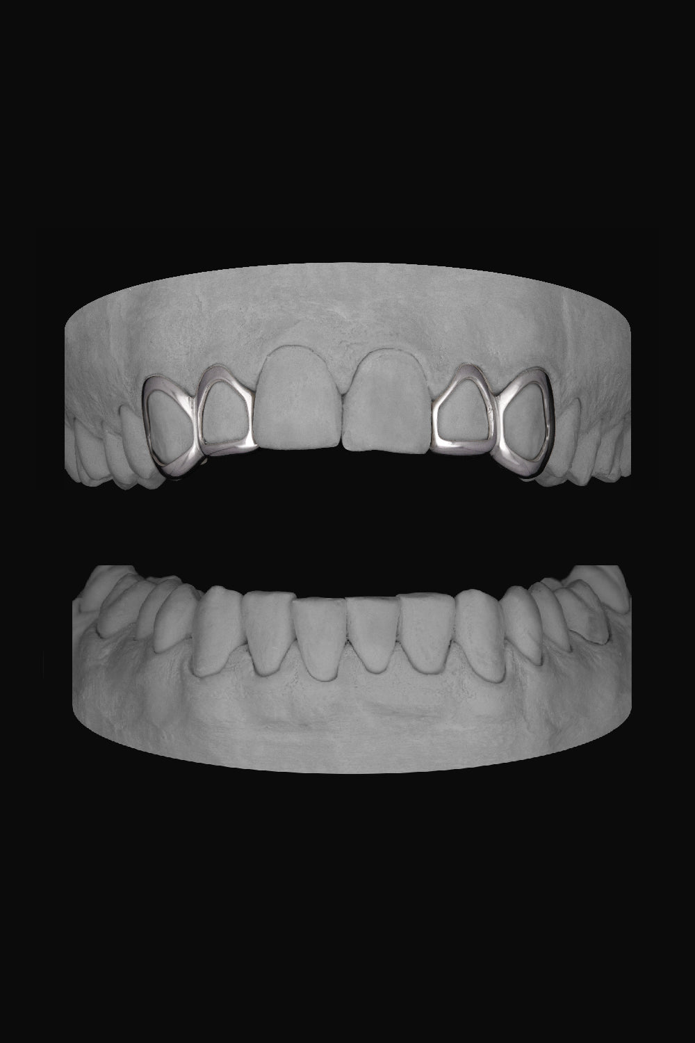 2 x Window Canine & Window Lateral