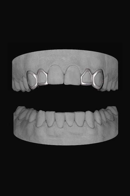 2 x Window Canine & Window Lateral