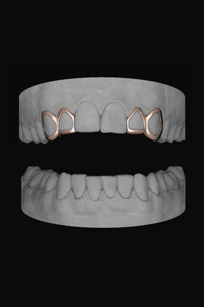 2 x Window Canine & Window Lateral