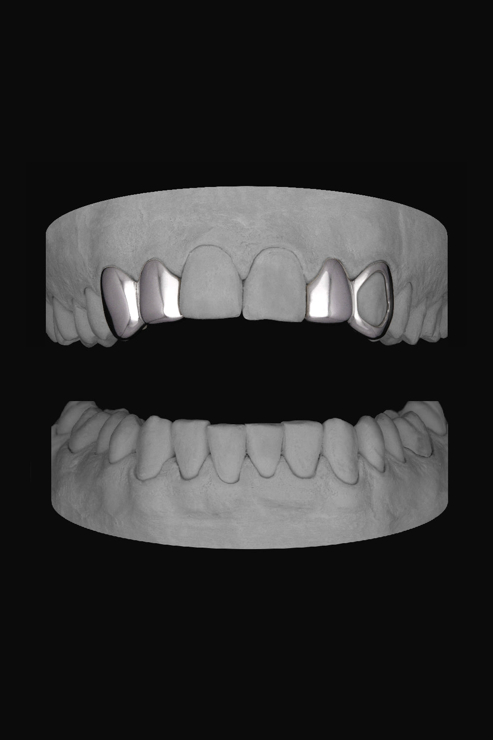 Canine & Lateral - Lateral & Window Canine