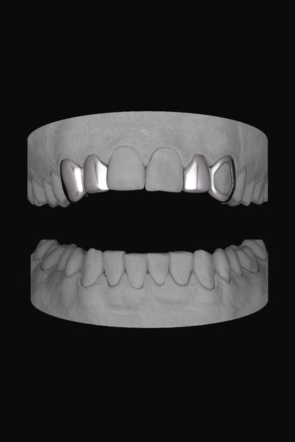 Canine & Lateral - Lateral & Window Canine