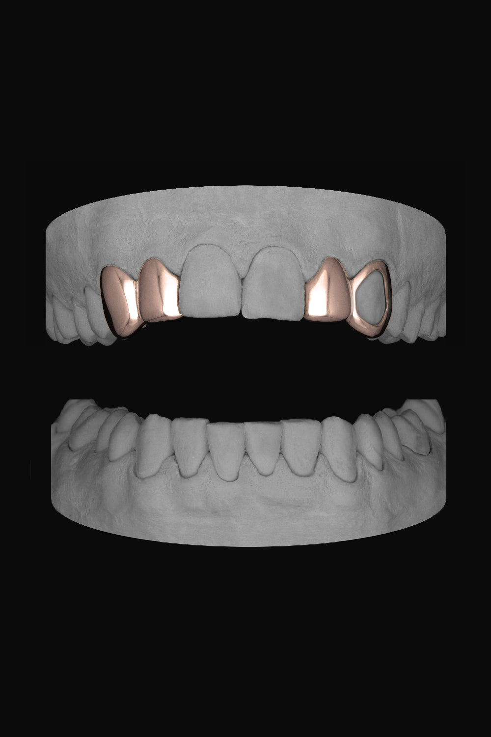 Canine & Lateral - Lateral & Window Canine