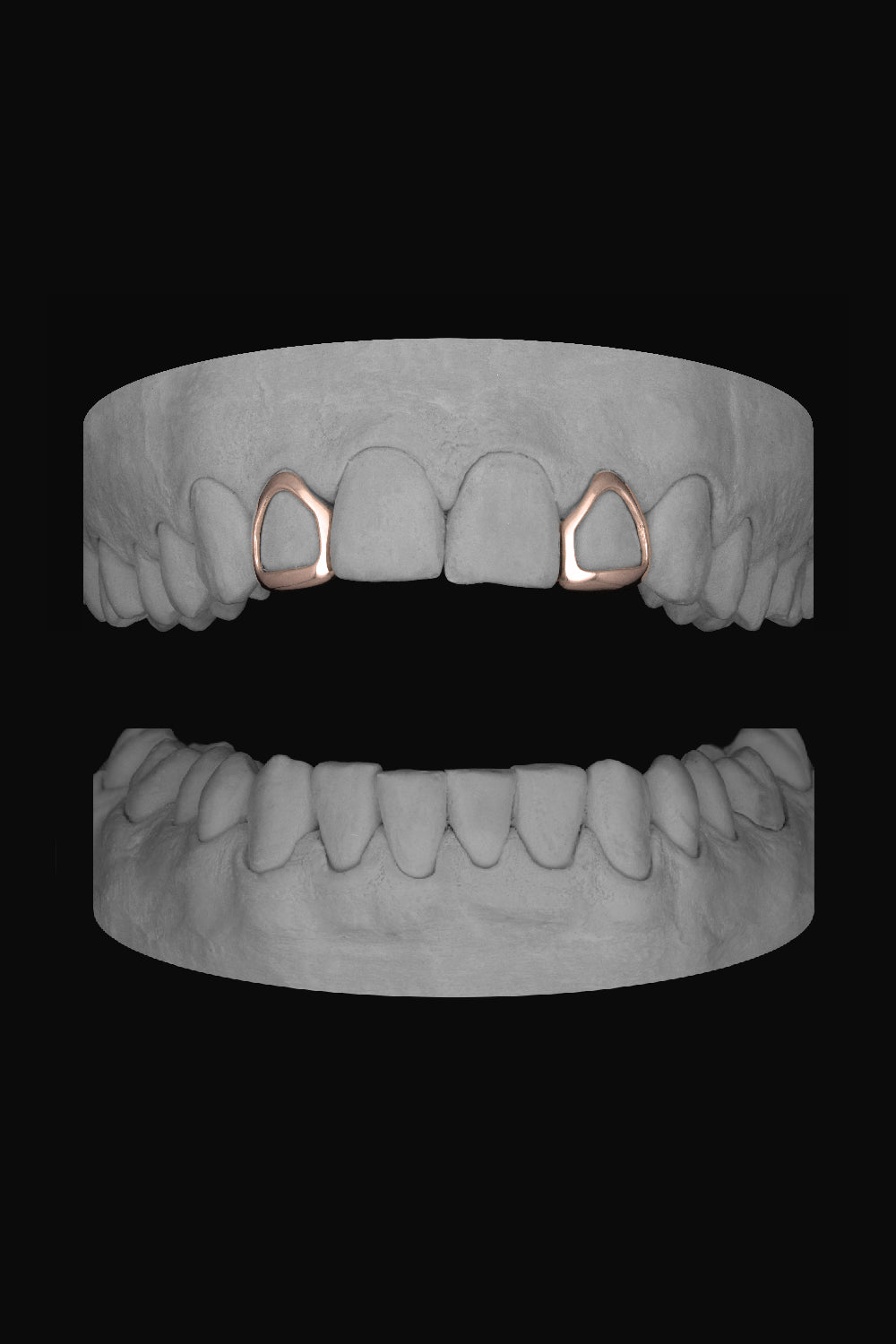 2 x Lateral Windows