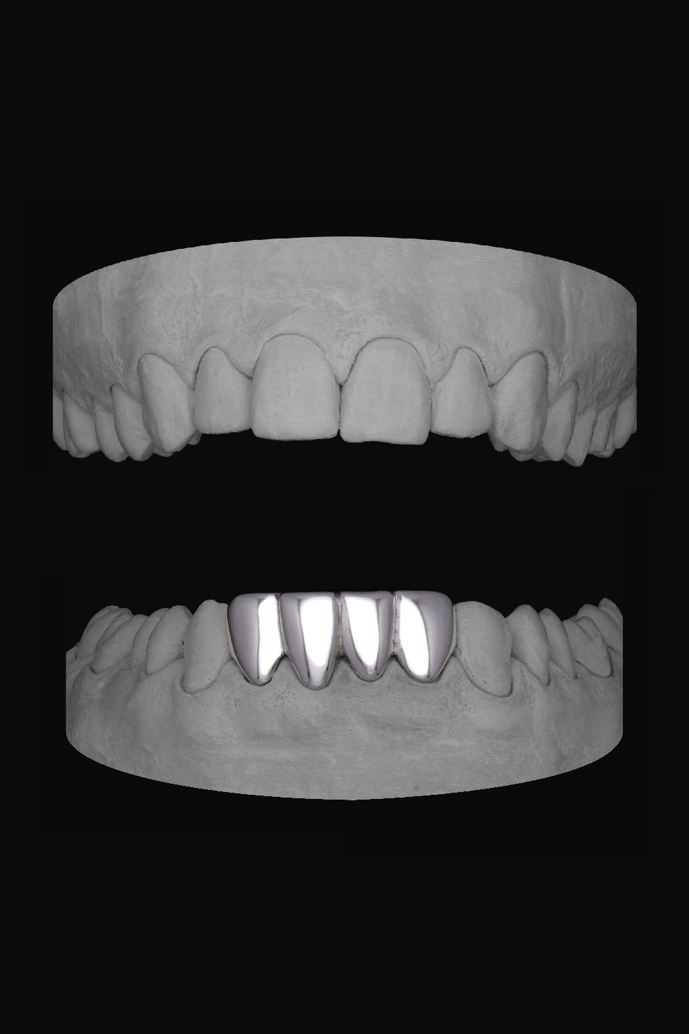 Lower 4 Set – K9GrillzUK