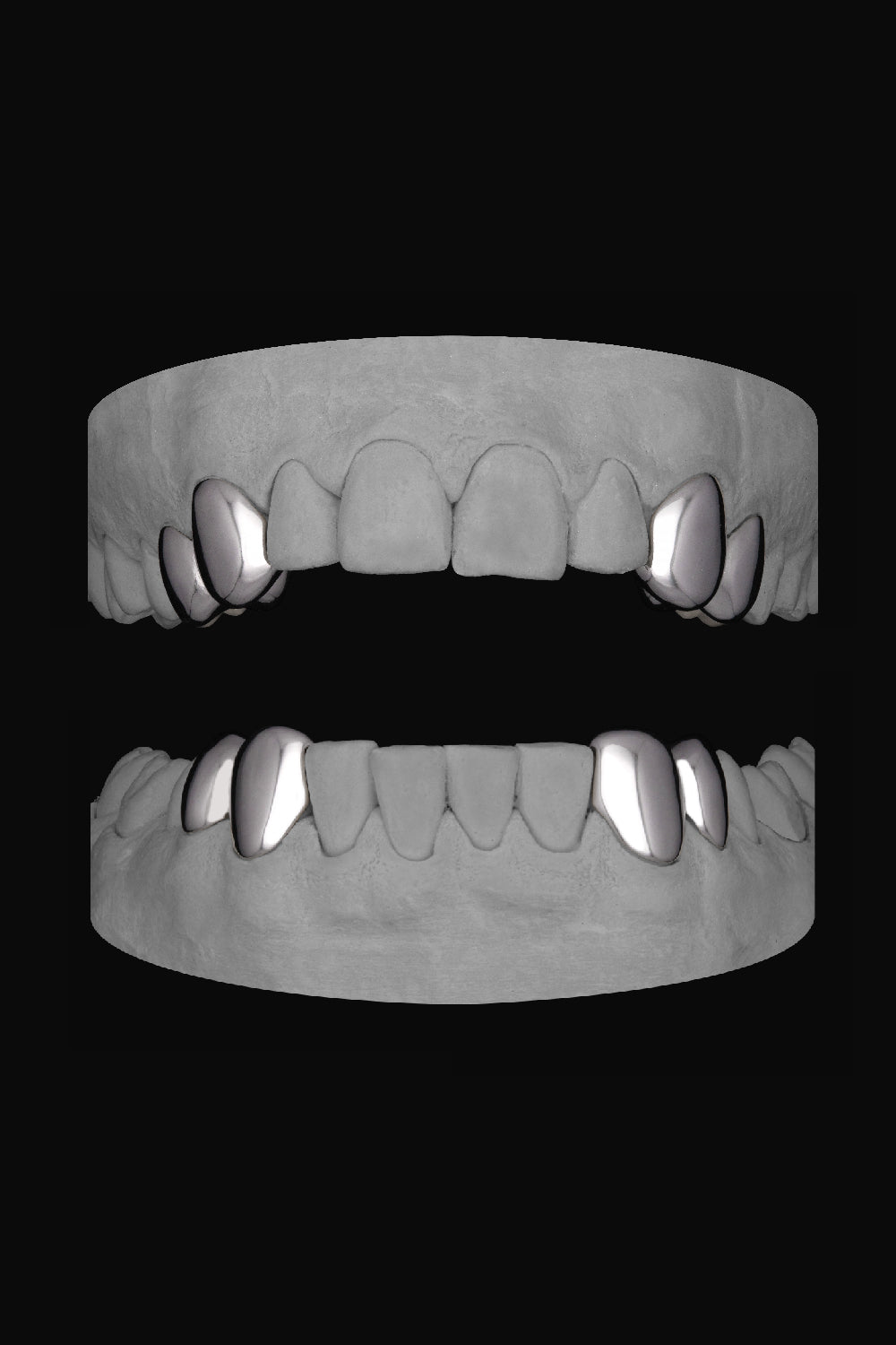 4 x Canine & Premolar