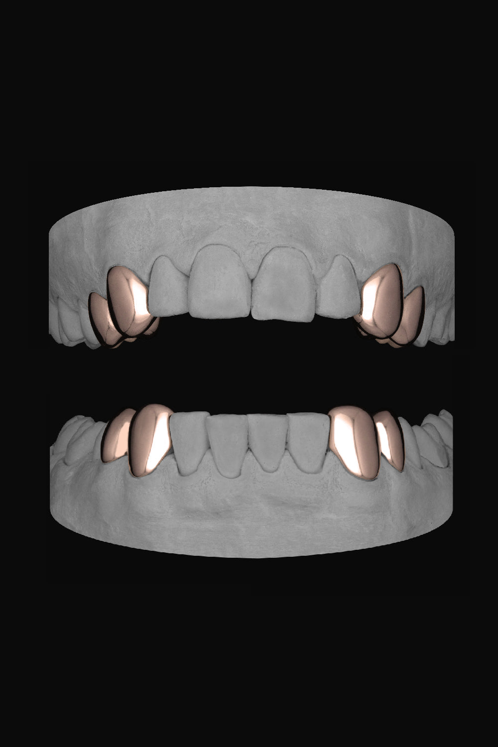4 x Canine & Premolar
