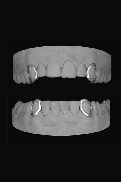 4 x Window Canines