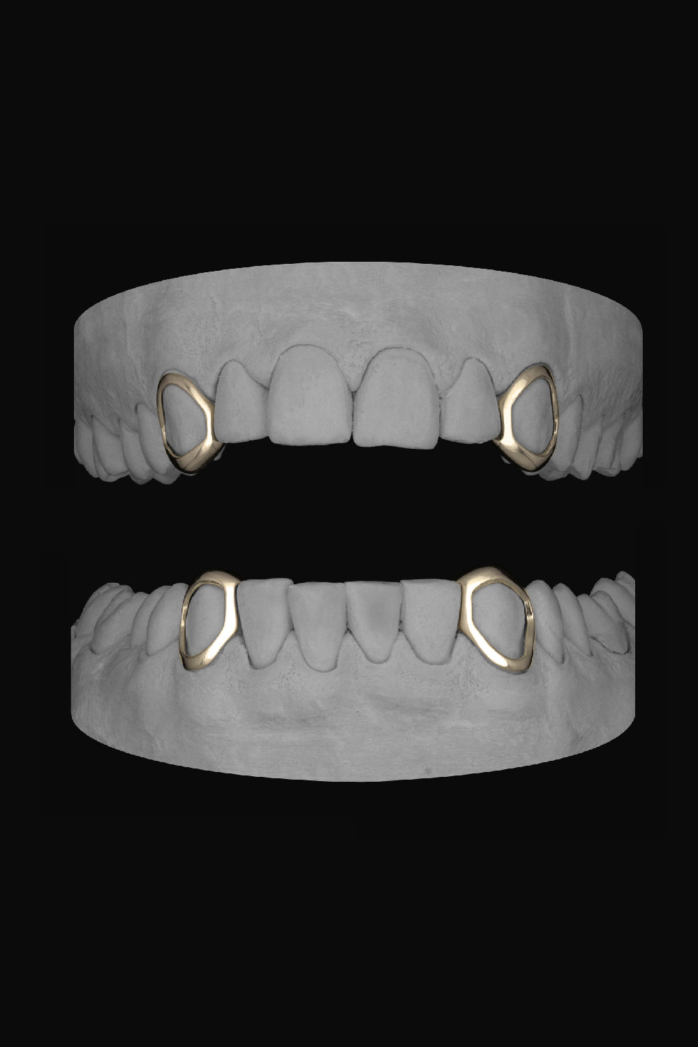 4 x Window Canines