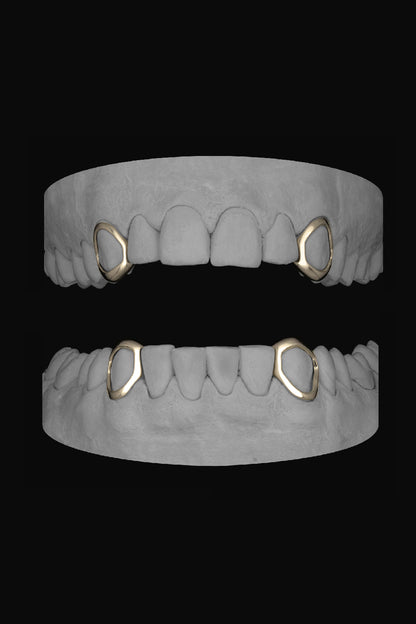 4 x Window Canines