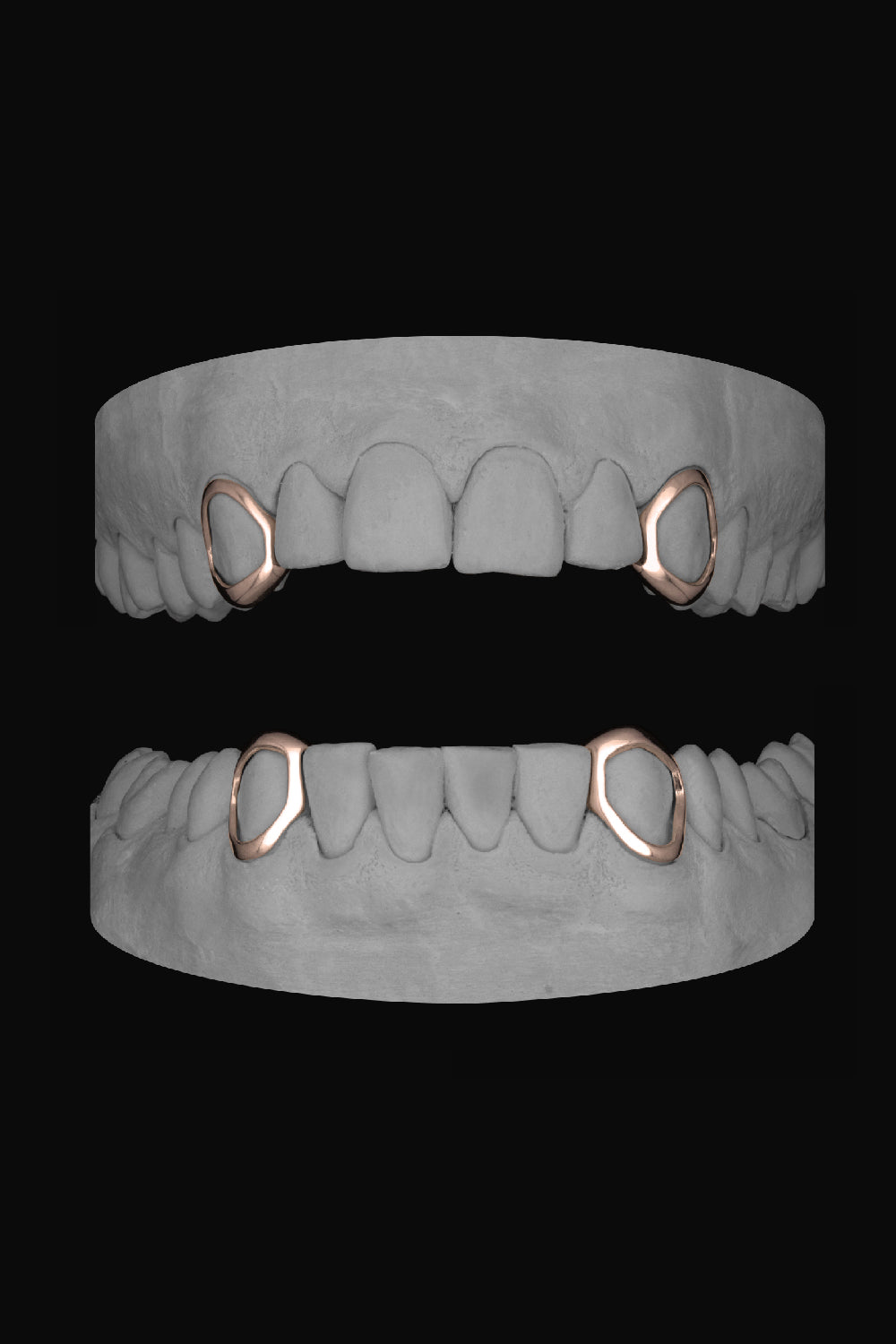 4 x Window Canines