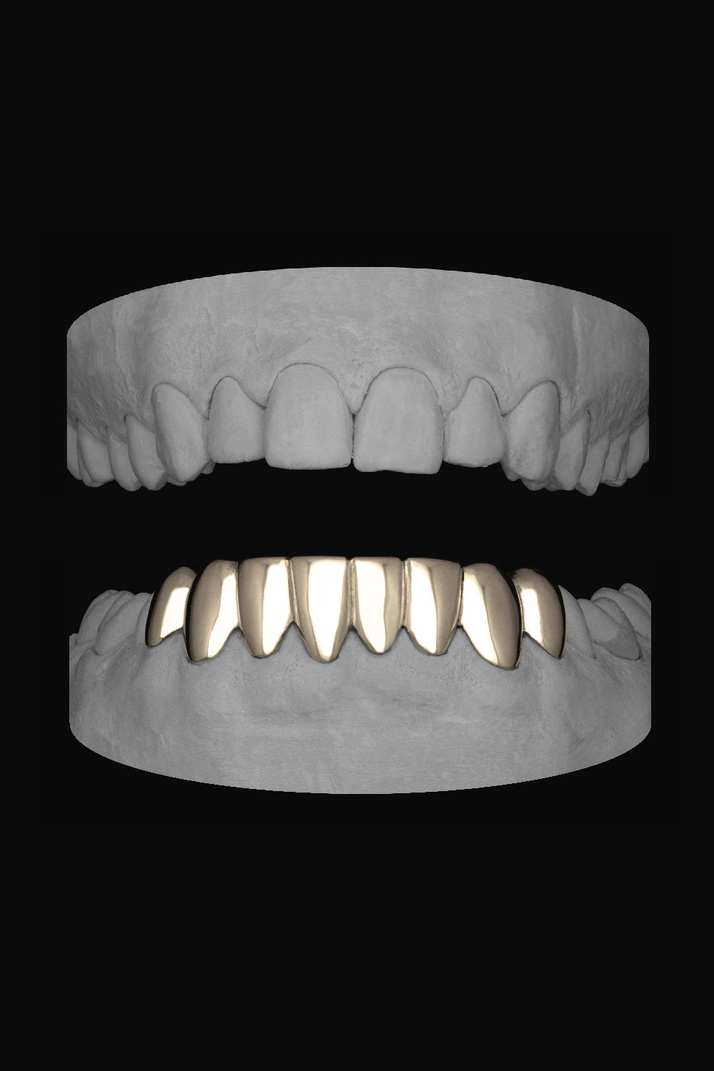 Bottom 8 Set