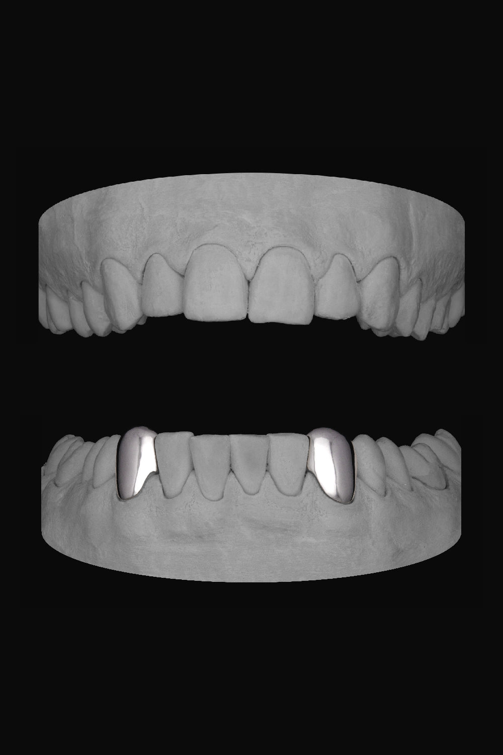 Canine - Canine (Lower)
