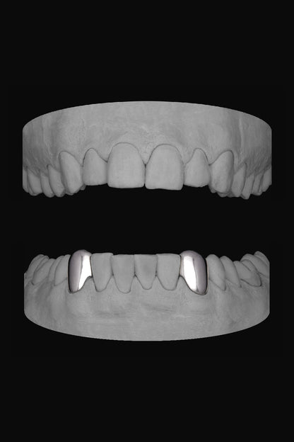 Canine - Canine (Lower)