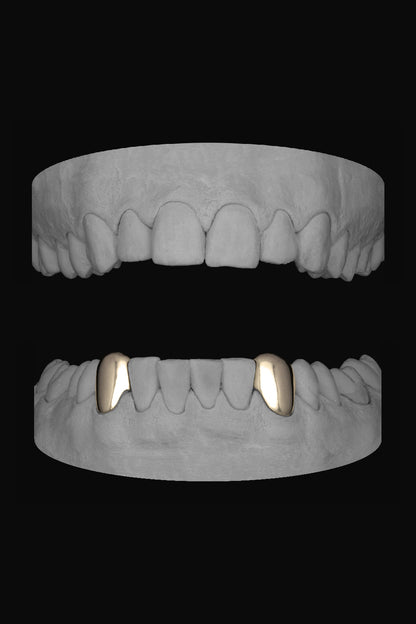 Canine - Canine (Lower)