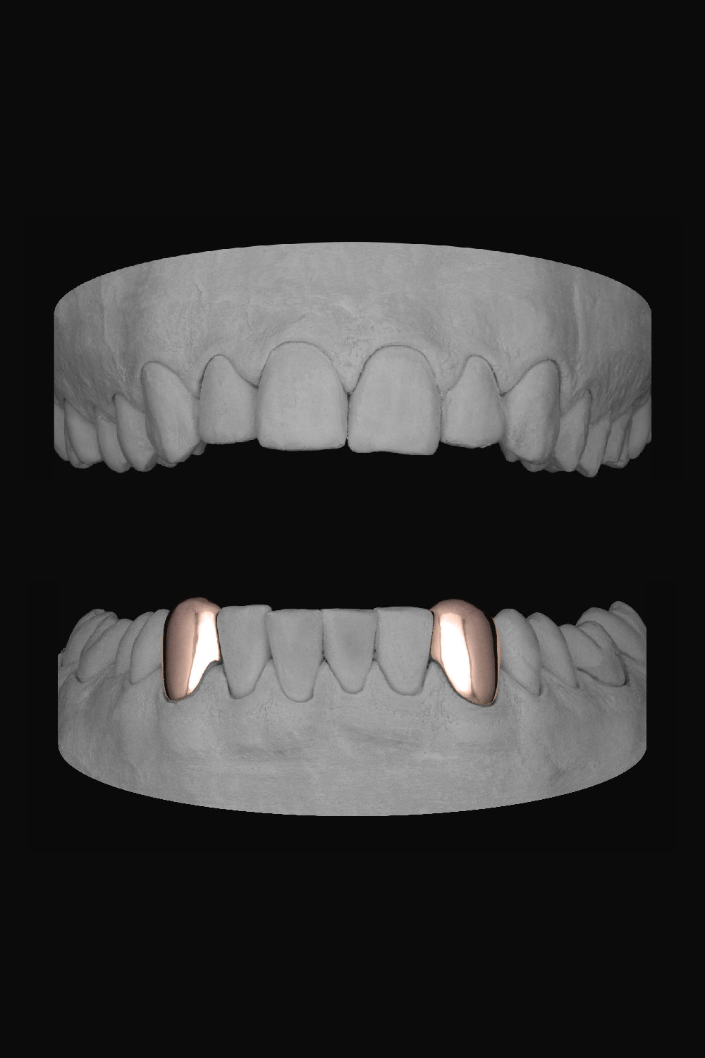 Canine - Canine (Lower)
