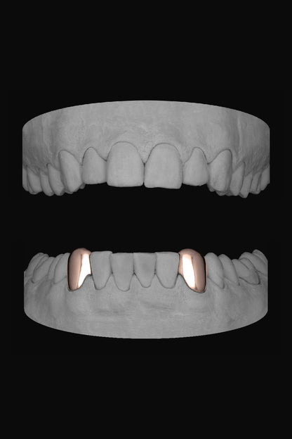 Canine - Canine (Lower)