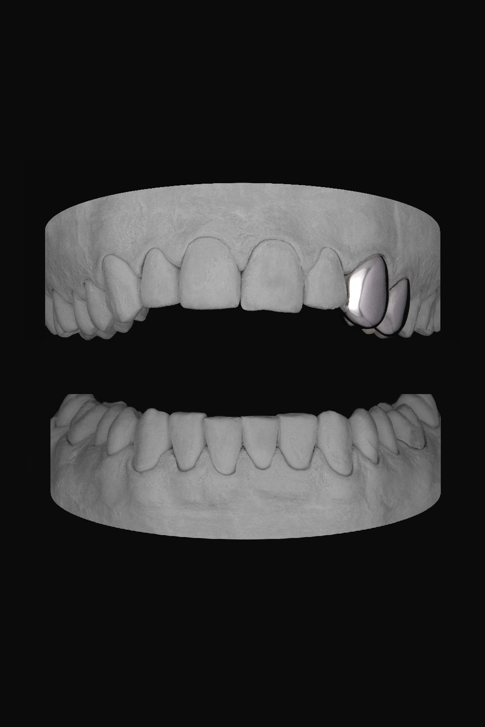 Canine & Premolar (Upper)