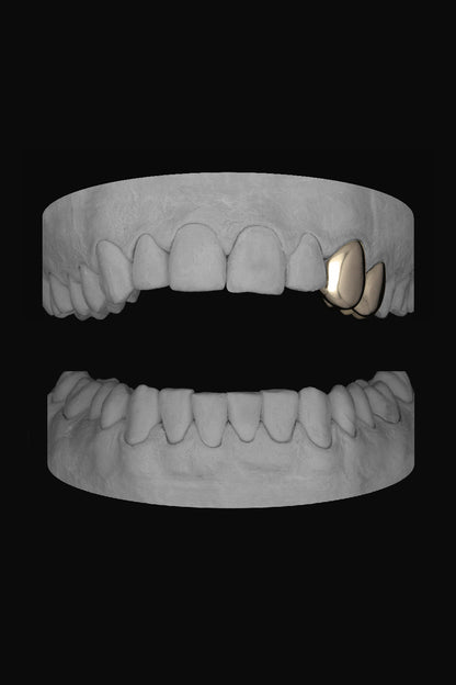 Canine & Premolar (Upper)
