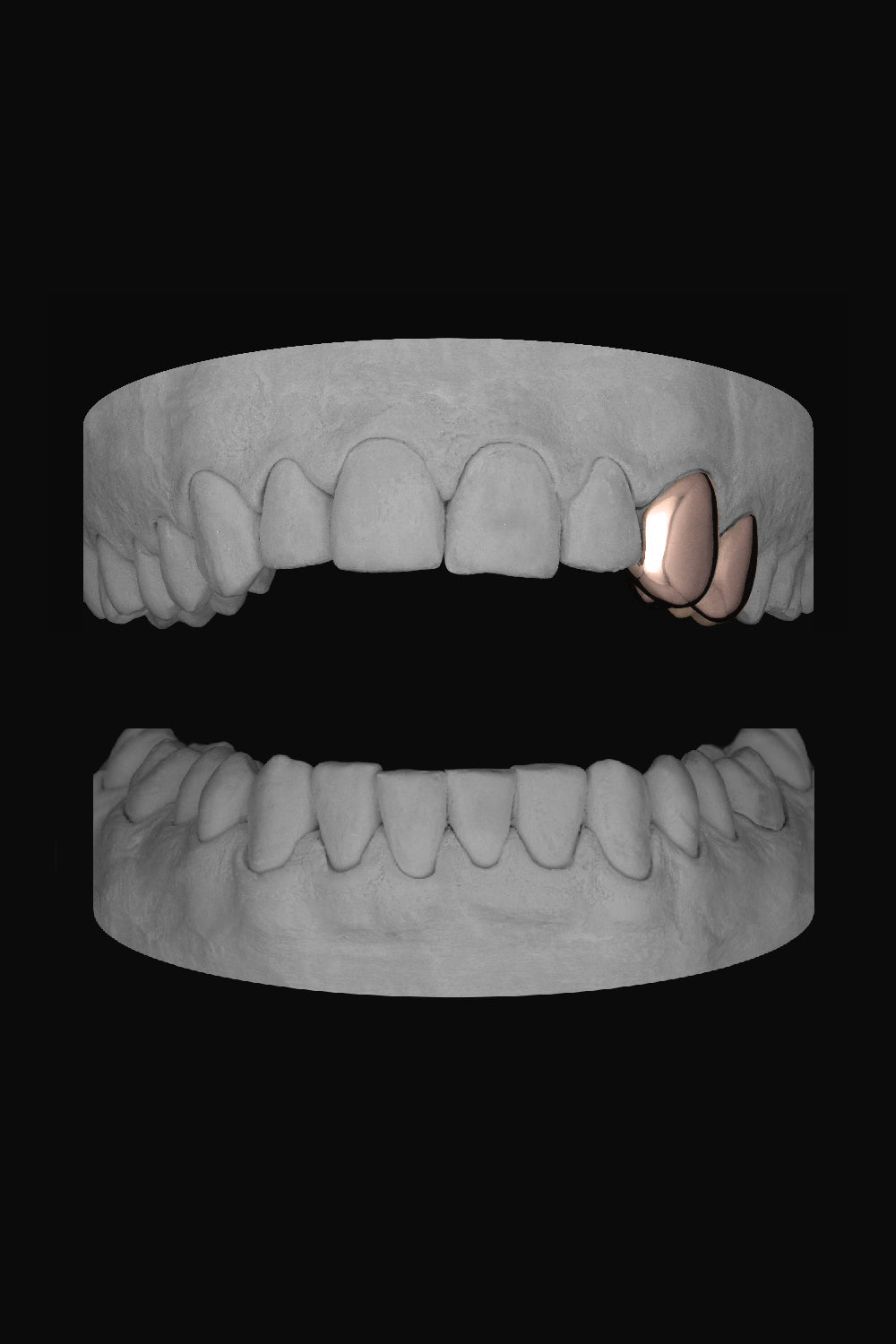 Canine & Premolar (Upper)